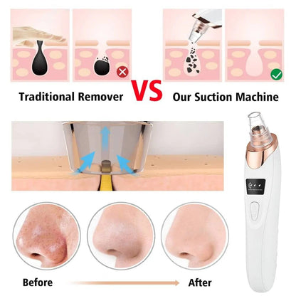 Blackhead Remover suction heads