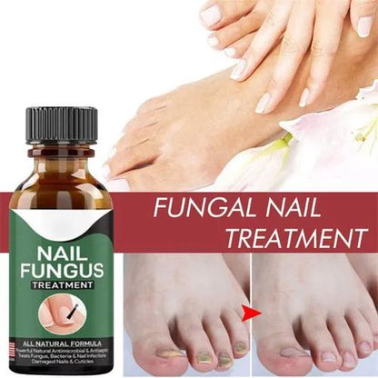 Fast Nail Fungal Treatments Nail Repair Serum