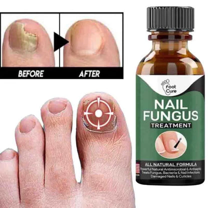 Fast Nail Fungal Treatments Nail Repair Serum