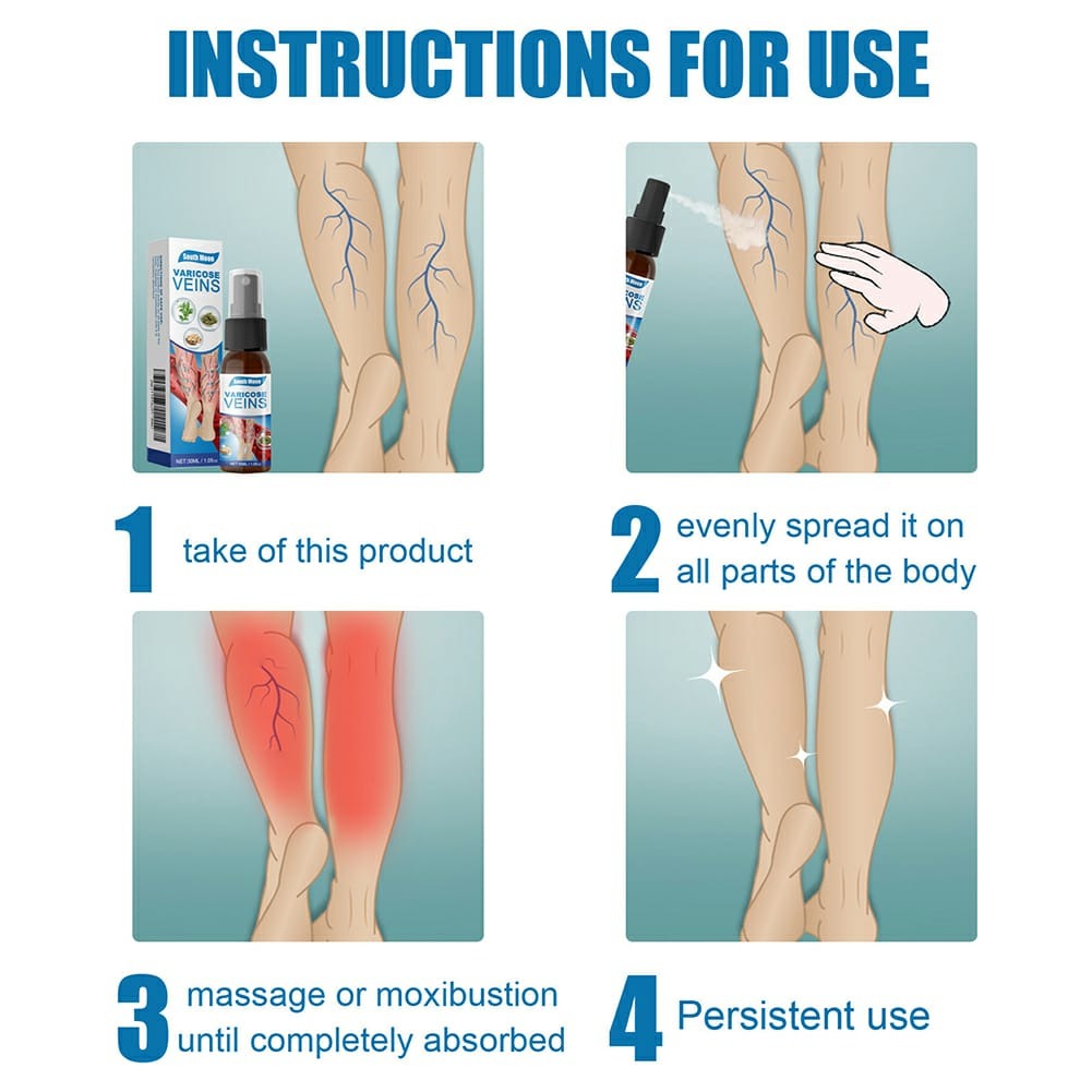 South Moon Varicose Veins Treatment Spray – 30ml Advanced Formula for Spider Veins, Leg Pain & Swelling Relief