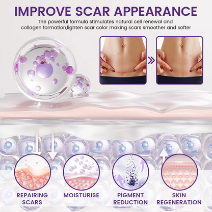 Timilk Regenscar Stem Cell Scar Gel 20g