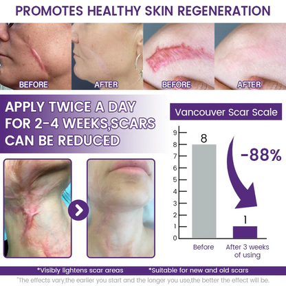 Timilk Regenscar Stem Cell Scar Gel 20g