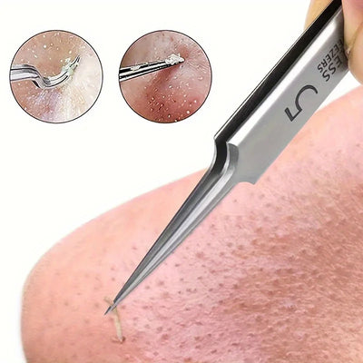 Extra Fine Acne & Blackhead Removal Tweezers - Stainless Steel