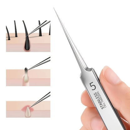 Extra Fine Acne & Blackhead Removal Tweezers - Stainless Steel