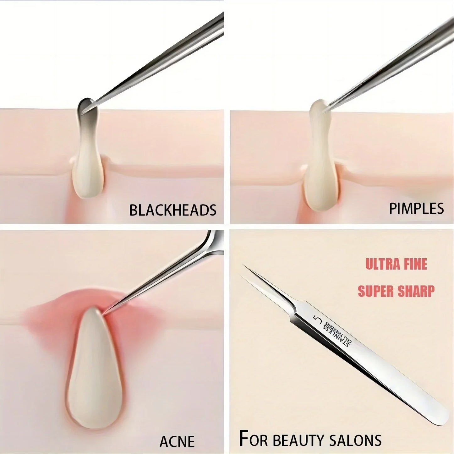 Extra Fine Acne & Blackhead Removal Tweezers - Stainless Steel