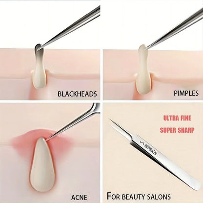 Extra Fine Acne & Blackhead Removal Tweezers - Stainless Steel